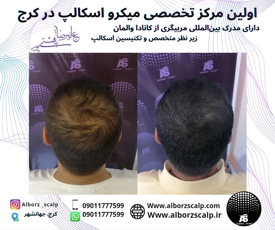 اولین مرکز تخصصی اسکالپ در کرج (علیرضا بهشتی پور) 09011777599